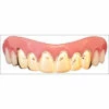 Billy Bob Teeth - Gold Veneers 2 Billy Bob Teeth - Gold Veneers -Smiffys Shop te5653g billy bob teeth gold veneers